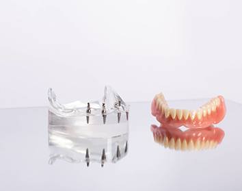 Sample implant dentures and clear base with implants on reflective surface