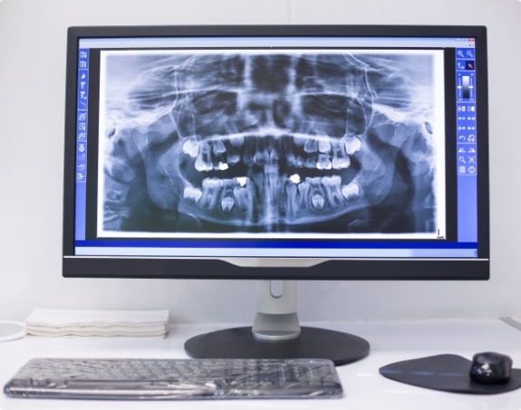 Digital x rays on chairside computer screen