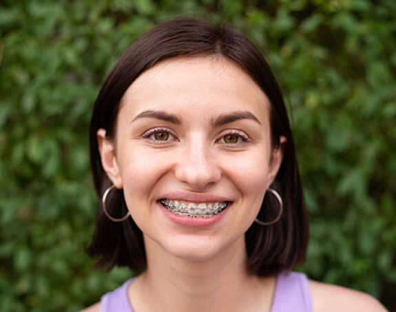 a young girl smiling and revealing her traditional braces