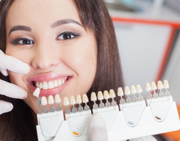 Woman's smile compared with veneers color charts