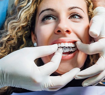 Dentist placing clear aligner on patient